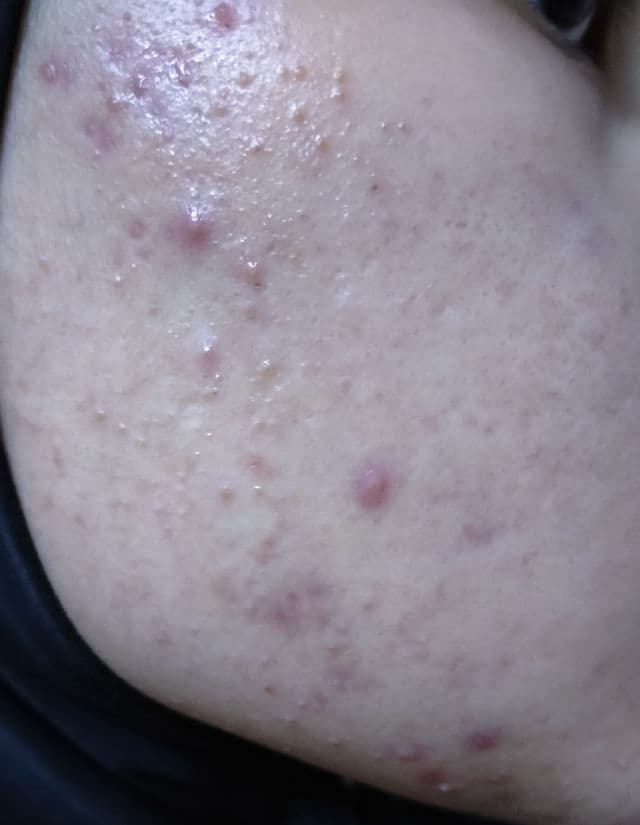 Somethinc Ceramic Skin Saviour Moisturizer Gel review photo by sweetie