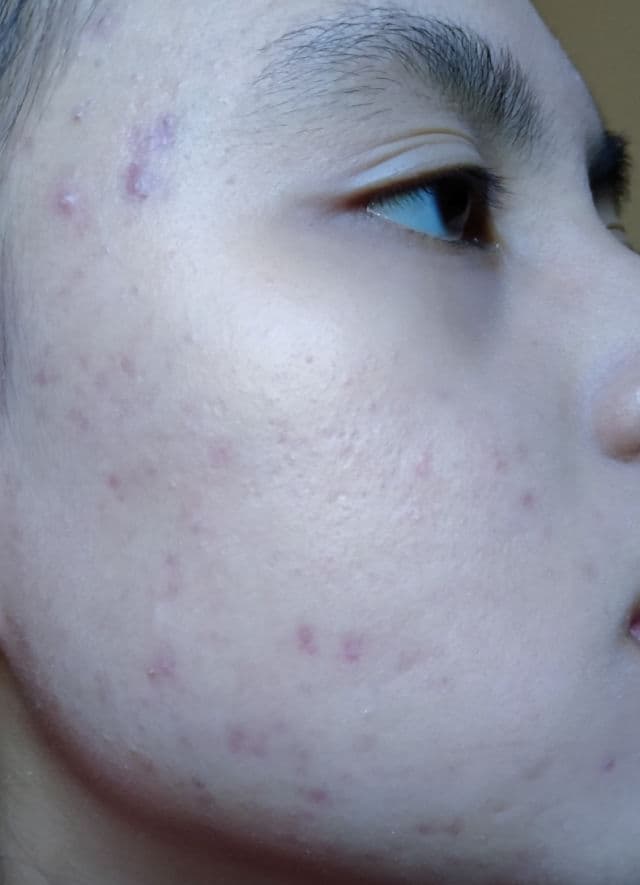 Somethinc Ceramic Skin Saviour Moisturizer Gel review photo by sweetie