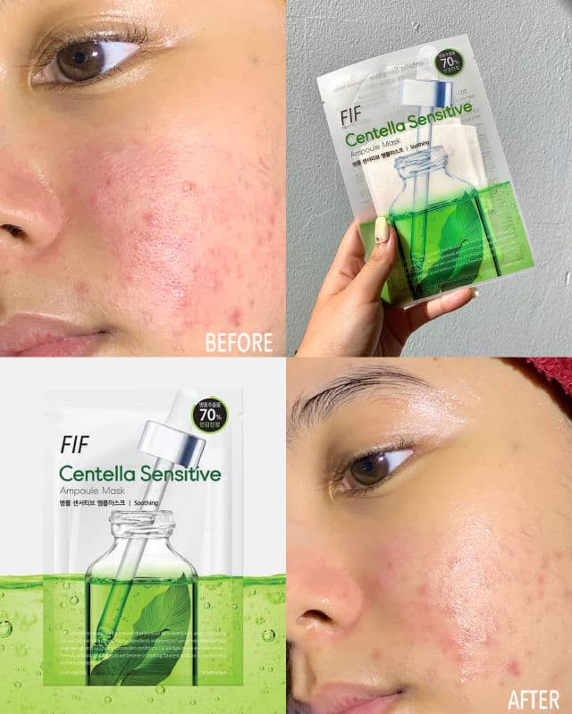 Faith in Face Centella Sensitive Ampoule Mask review photo by syafflyn