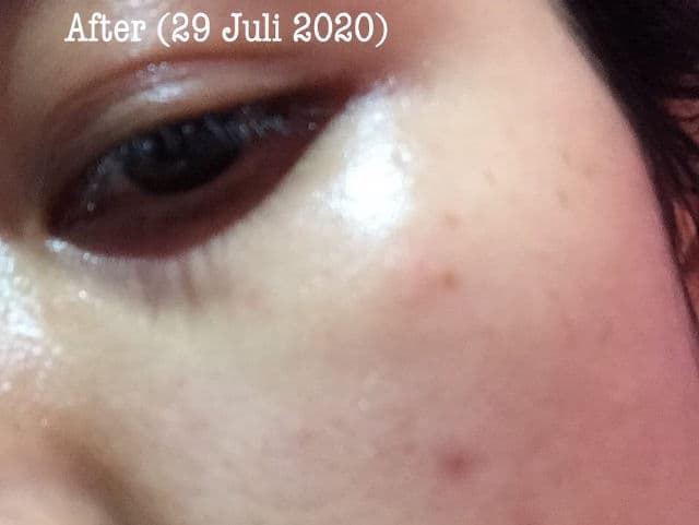 The Yeon Canola Honey Propolis Ampoule review photo by syahnidaareo