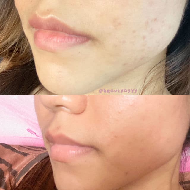 Indoganic Bakuchiol Intensive Face Oil review photo by tasyafrdla