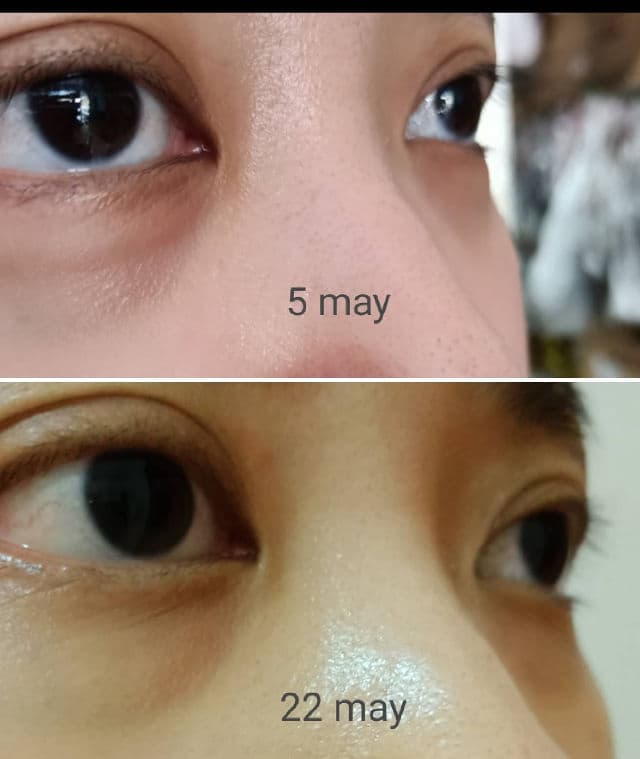 medi-peel Peptide 9 Hyaluronic Volumy Eye Cream review photo by tawtaw88