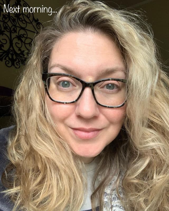 Peace Out Acne Dots review photo by thebeautybops