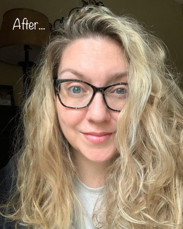 Peace Out Acne Dots review photo by thebeautybops