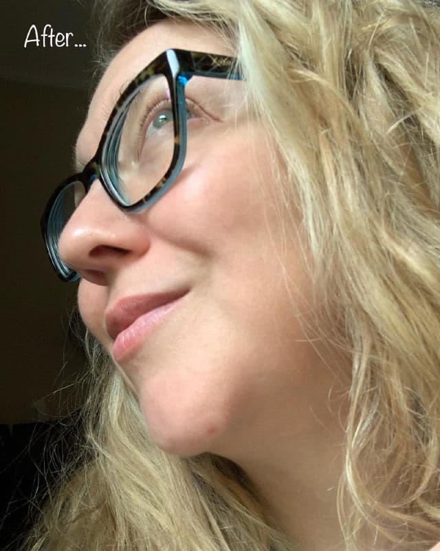 Peace Out Acne Dots review photo by thebeautybops