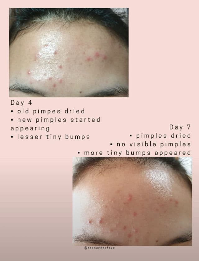 Sferangs Clearing T-Care AMED A Spot Solution review photo by thesundaefave