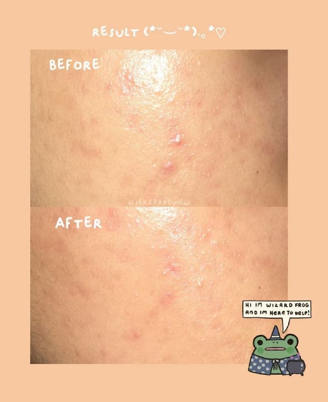 datglowskin Ceramide + Ginseng Skinbar Serum review photo by wh