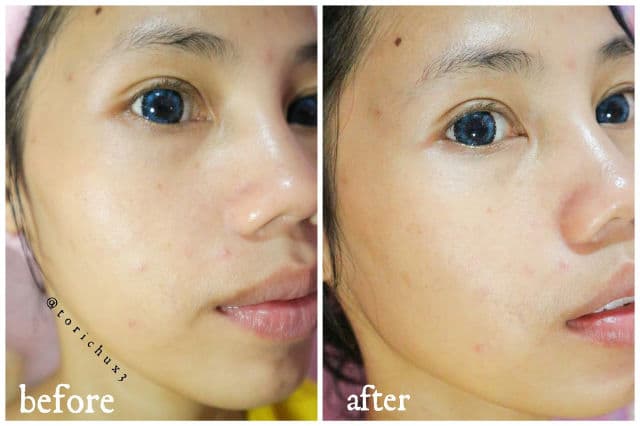 BENTON PHA Peeling Gel review photo by torichu