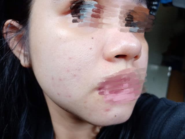 Dermorepubliq Snail Mucin + Botanical Extracts Clarifying Toner review photo by tyaraa