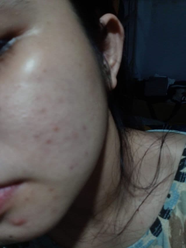 Dermorepubliq Alpha Arbutin + Snail Mucin Brightening Serum review photo by tyaraa