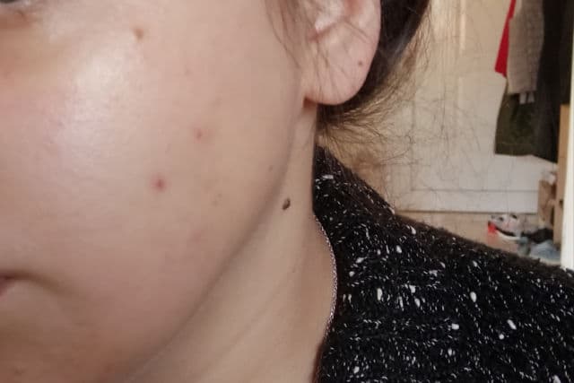 Jumiso Yes I Am Toner AHA 5% review photo by vivonius