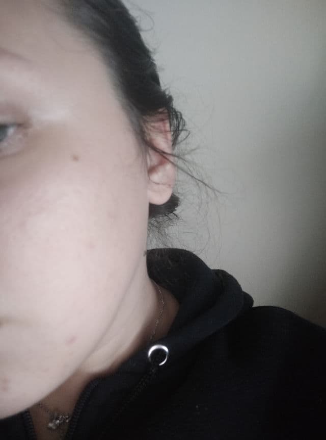 Jumiso Yes I Am Toner AHA 5% review photo by vivonius