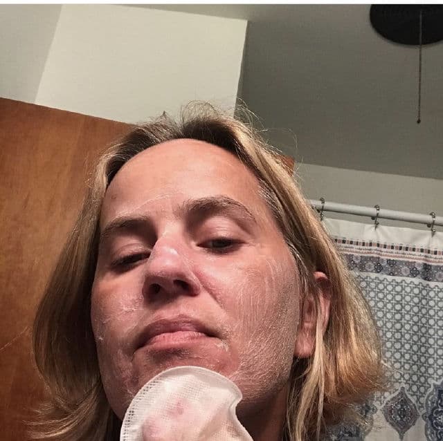 Beautree PLA Bubble Exfoliating Cleansing Pads review photo by warrent23