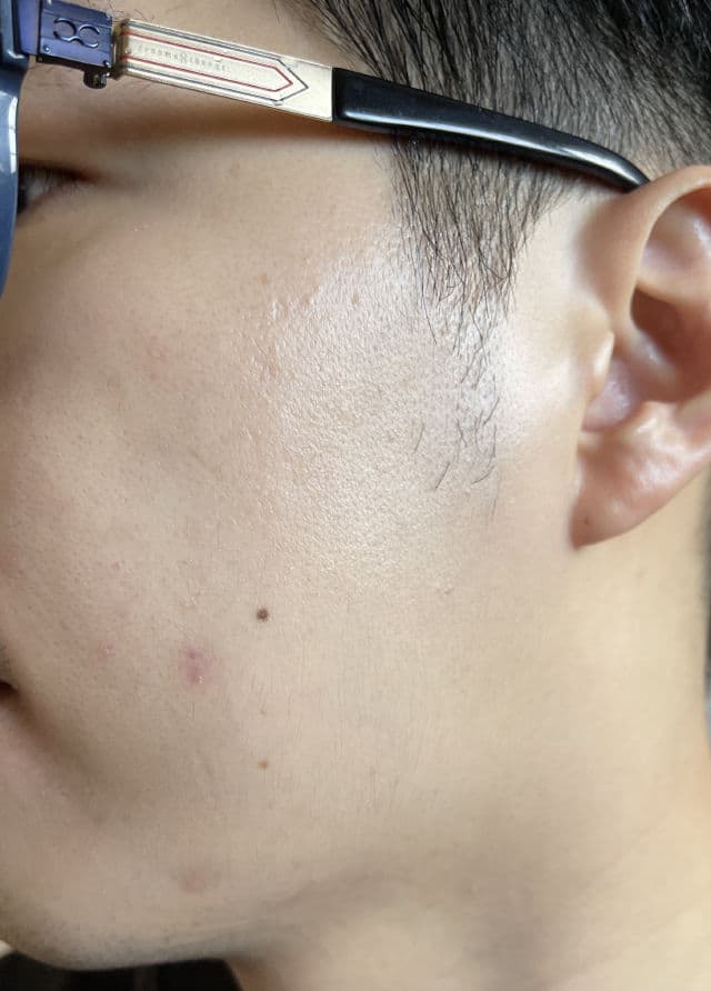 Natura Chronos Dark Spot Corrector 10% Pure Vitamin C review photo by weikian90