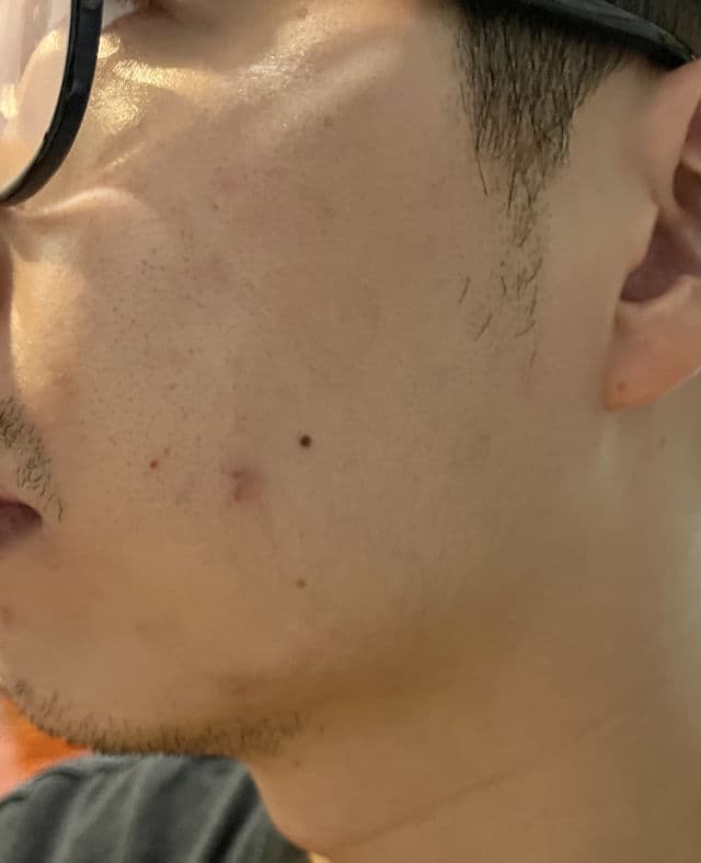 Natura Chronos Dark Spot Corrector 10% Pure Vitamin C review photo by weikian90