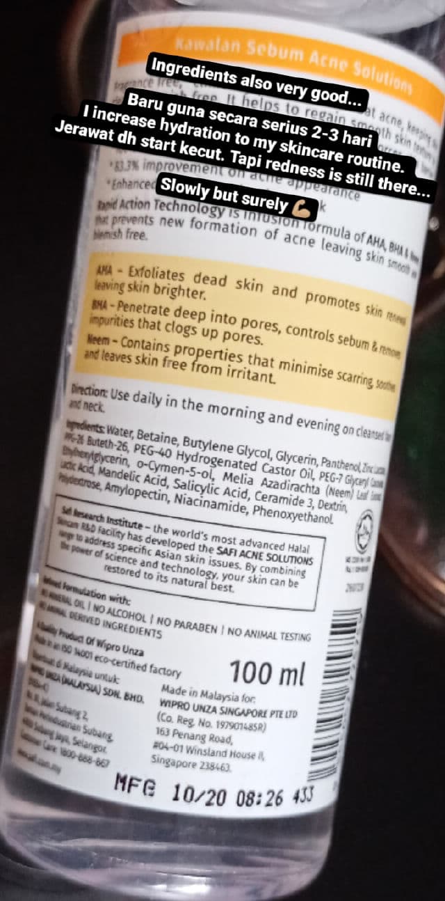 Safi Acne Solution Sebum Control Fluid review photo by Nsafurazh