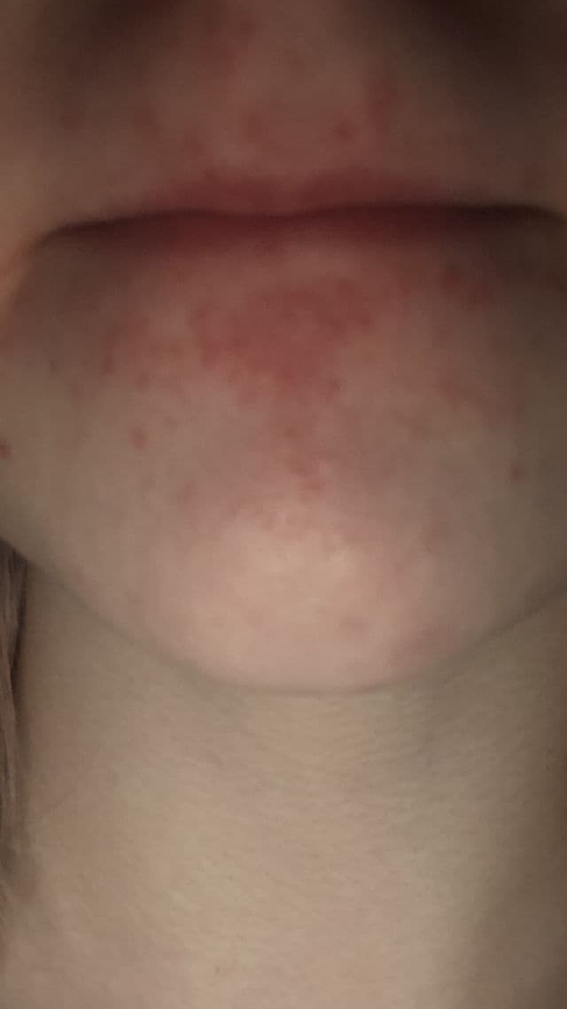 E45 Cream review photo by deuseczemachina