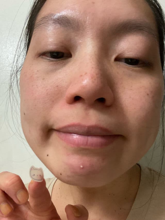 LitBear Acne Patch Pimple Patch Cat Shaped review photo by NguyenAndOngLy