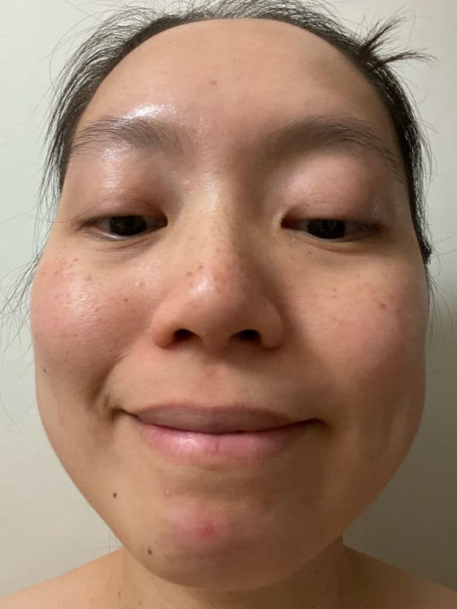 LitBear Acne Patch Pimple Patch Cat Shaped review photo by NguyenAndOngLy