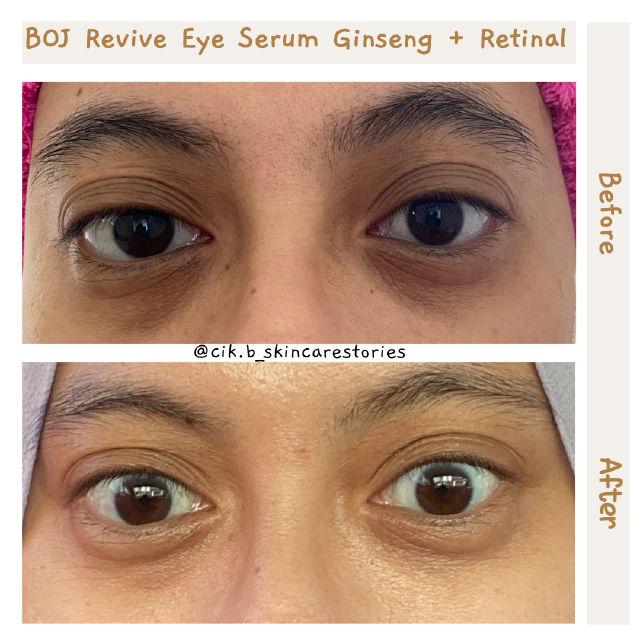 Revive Eye Serum Ginseng + Retinal product review