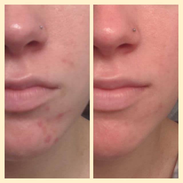 Phyla Phortify Probiotic Serum review photo by Renterese