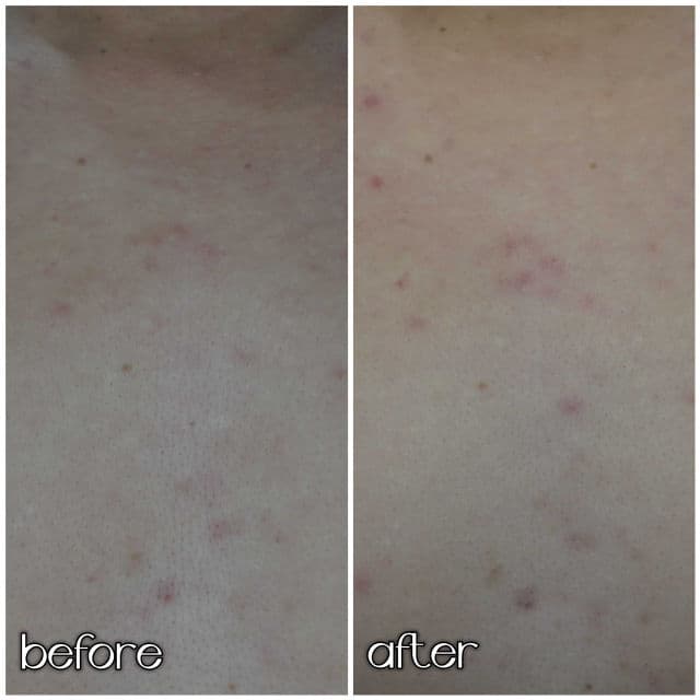 Dove Body Wash Sensitive Skin review photo by danielwonderland