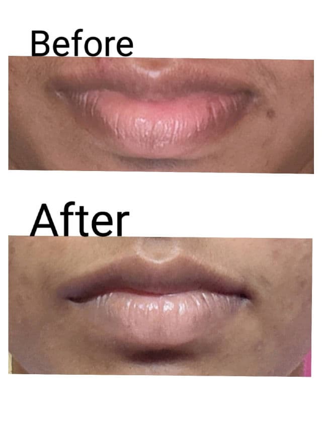 Minimalist L-Ascorbic Acid 08% Lip Treatment Balm review photo by Lsv