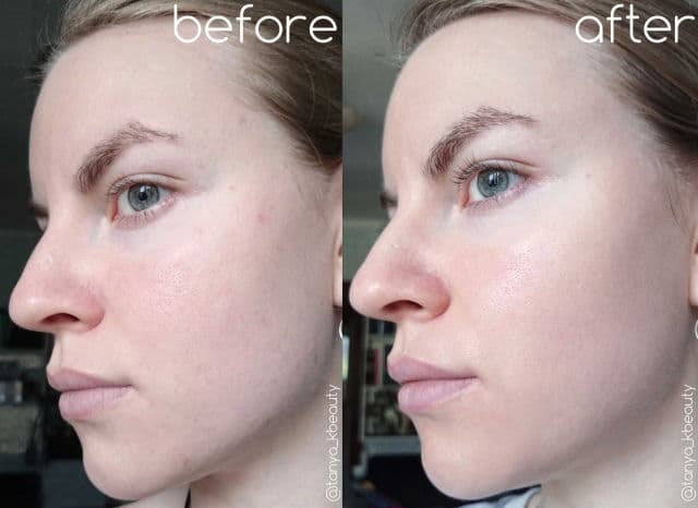 Some By Mi AHA 10% Amino Peeling Ampoule review photo by TanyaKbeauty