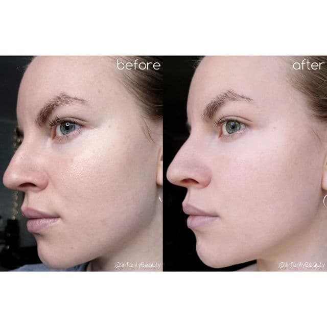 ISNTREE Clear Skin AB Peeling Pads review photo by TanyaKbeauty