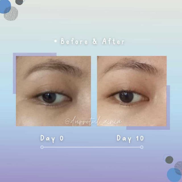 Somethinc 3% Astaxanthin + Chlorelina Serum review photo by durrotulainia