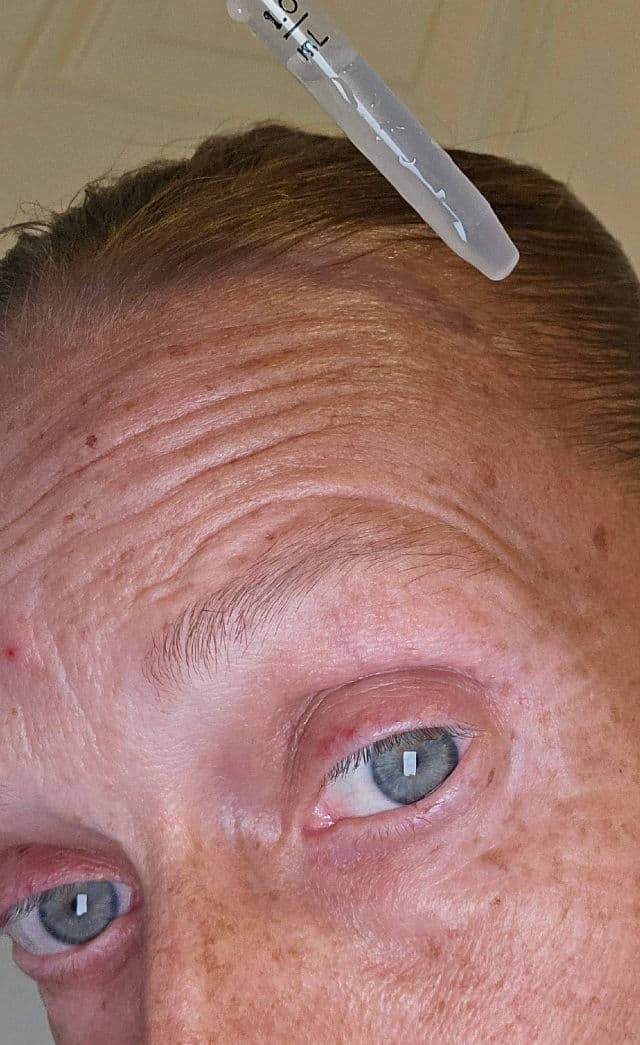 SheaMoisture Minoxidil 2% Hair Treatment Solution review photo by vgoodwin93