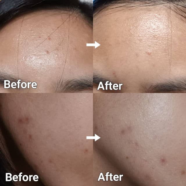 Luxe Organix Whitening Repair Serum Niacinamide 10% review photo by Avrelayne