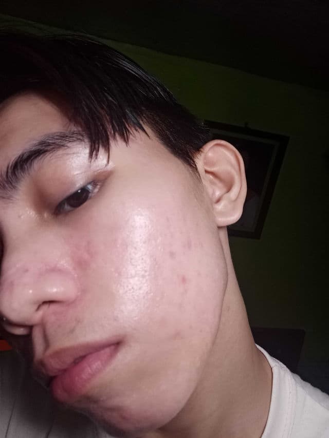 Oxecure Blackhead Clearing BHA PHA Toner review photo by SenseiDarwin