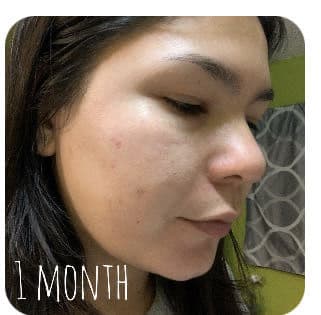 Eucerin Even Pigment Perfector Spot Corrector review photo by rbkdevelasco