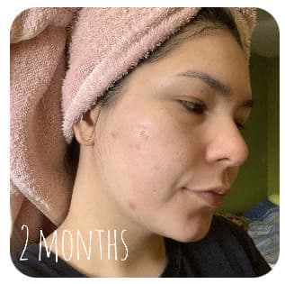 Eucerin Even Pigment Perfector Spot Corrector review photo by rbkdevelasco