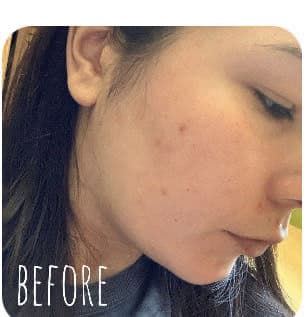 Eucerin Even Pigment Perfector Spot Corrector review photo by rbkdevelasco