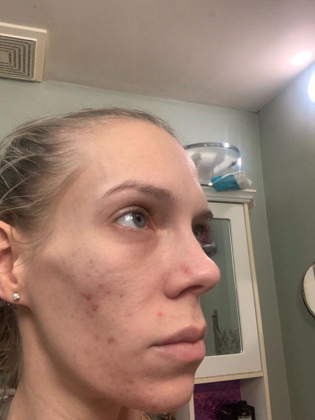 Daily Clarifying Peel product review