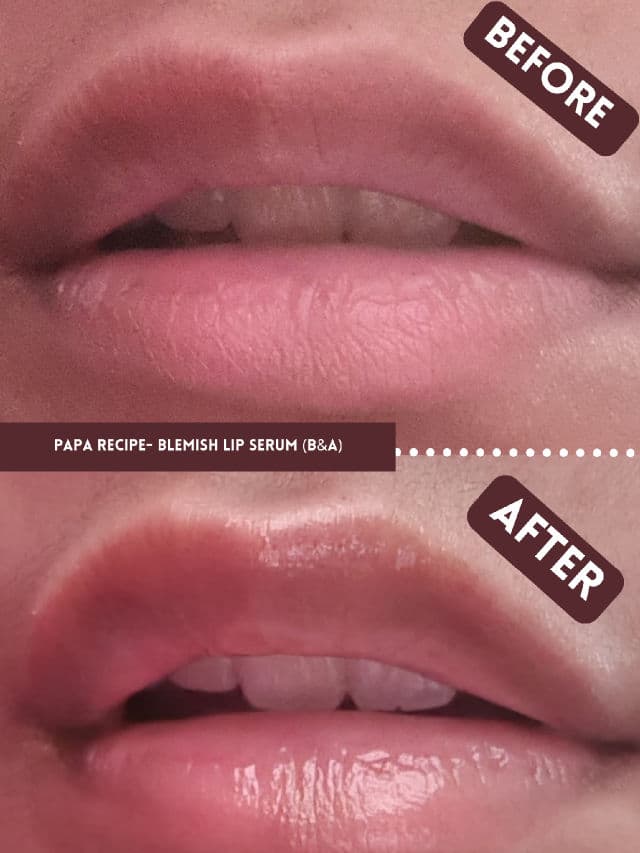 PAPA RECIPE Blemish Lip Serum review photo by narynnx