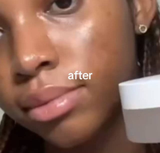 SNP Glutathione Dark Zero Toning Patch review photo by stillellaann