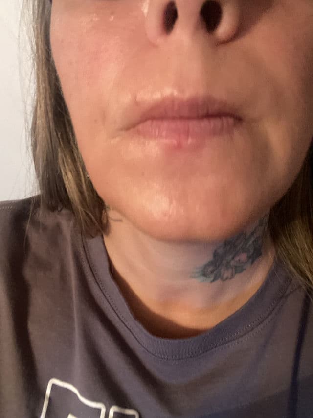 Perricone MD Acne Relief Calming Treatment & Hydrator review photo by chasi