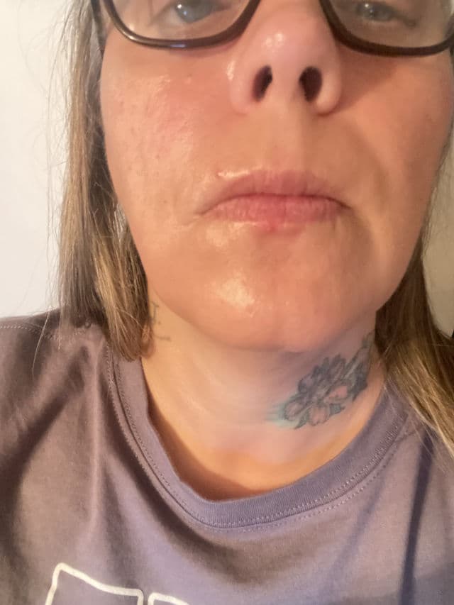 Perricone MD Acne Relief Calming Treatment & Hydrator review photo by chasi