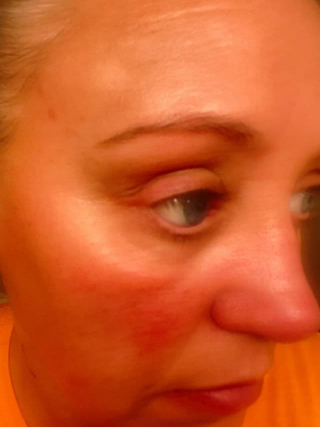 Eclat Eyelash Growth Serum review photo by chasi