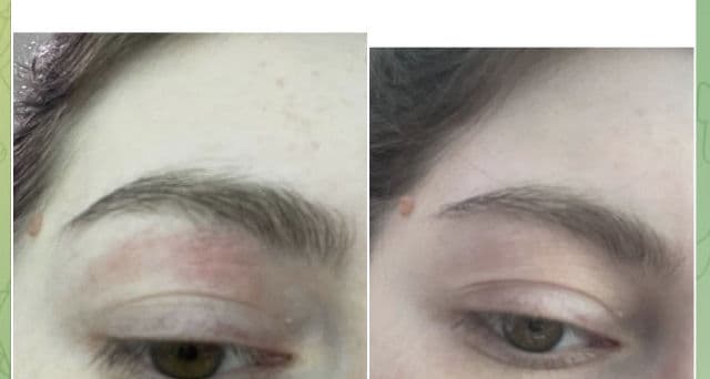 La Roche-Posay Toleriane Ultra Dermallergo Serum review photo by itsmybeauty