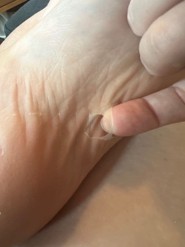 Baby Foot Exfoliation Foot Peel review photo by mormor