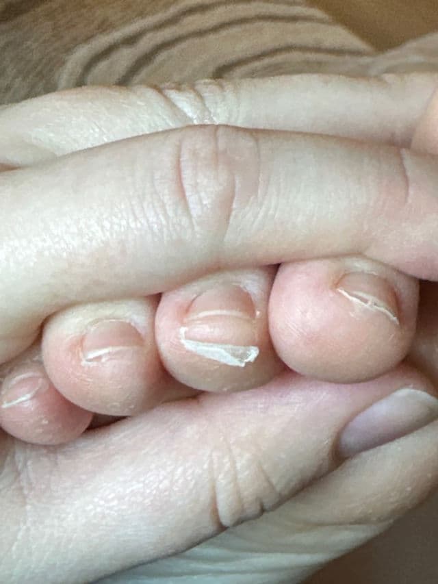 Baby Foot Exfoliation Foot Peel review photo by mormor