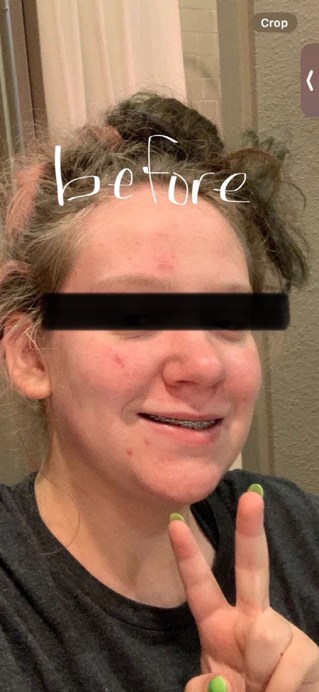 Pretty Skin Rice & Niacinamide Toner review photo by sophsy