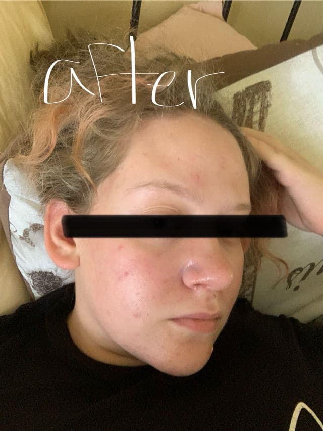 Pretty Skin Rice & Niacinamide Toner review photo by sophsy