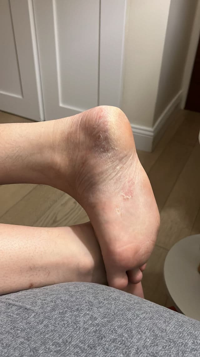 ELIZAVECCA CER-100 Collagen Coating Hair A+ Muscle Fixer Spray review photo by Rayssah