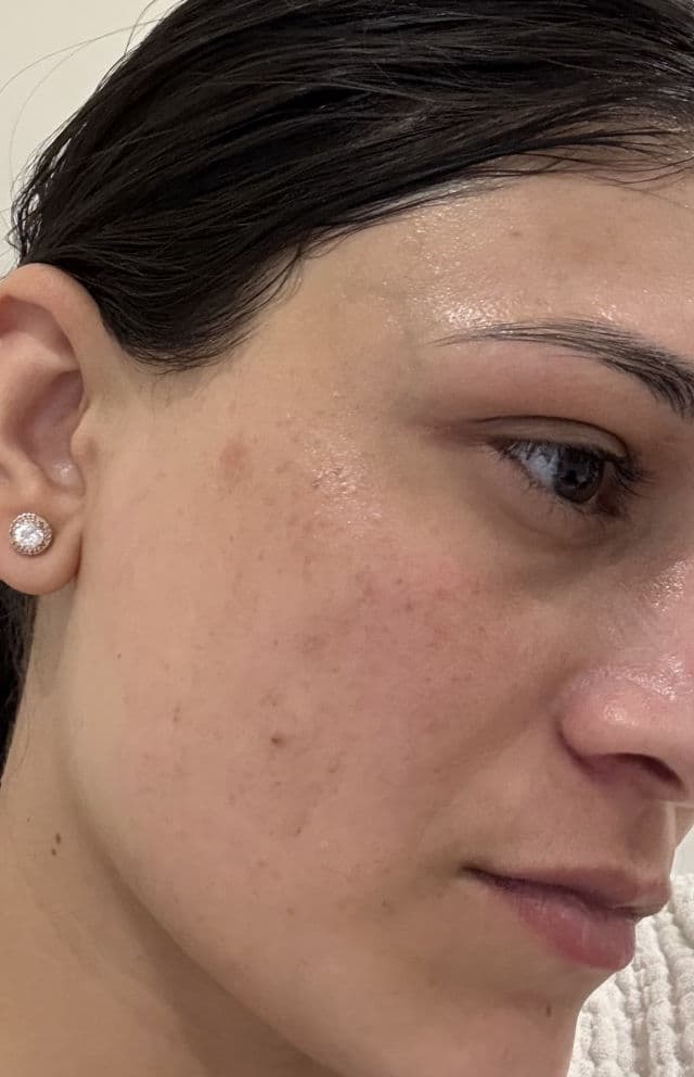 Simple Vital Vitamin Day Cream SPF15 review photo by Abah