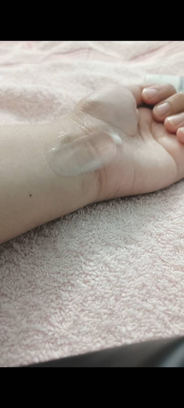 CeraVe Acne Foaming Cream Wash with Benzoyl Peroxide 10% review photo by aurora33